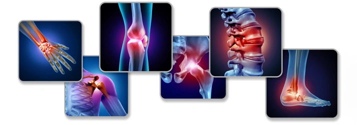 A set of medical graphics showing inflammation across various joints including spine, knee, and wrist.