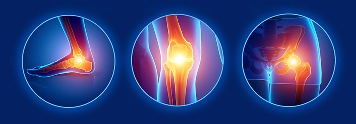 Illustrations highlighting pain points in the ankle, knee, and hip joints with glowing effects.
